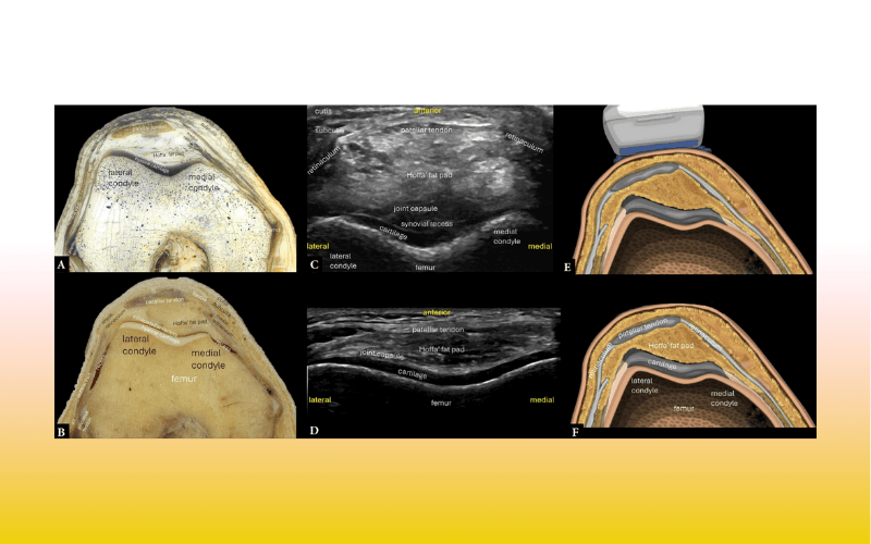 5. Compartimento anterior rodilla tempo formacion.png